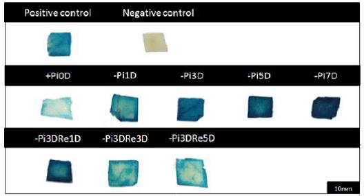 Development of an in planta system to monitor phosphorus status by agroinfiltration and agroinjection